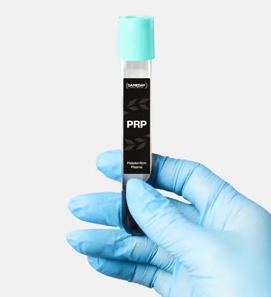 Prp Hair Photo