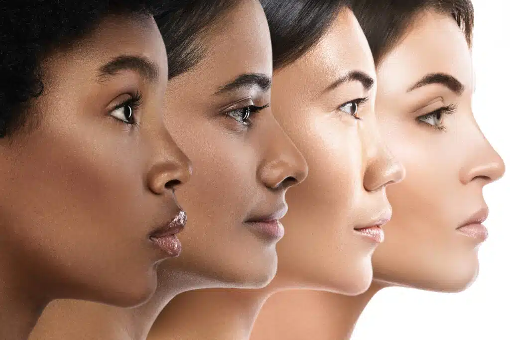 Diverse Side Profiles Showing The Results Of Facial Treatments For A Refined Look.