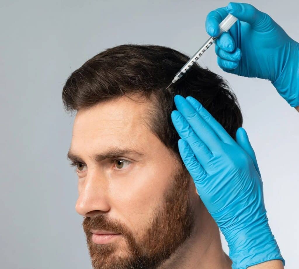 Man-with-short-hair-and-beard-receiving-hair-treatment-with-injection-by-a-professional-in-blue-gloves